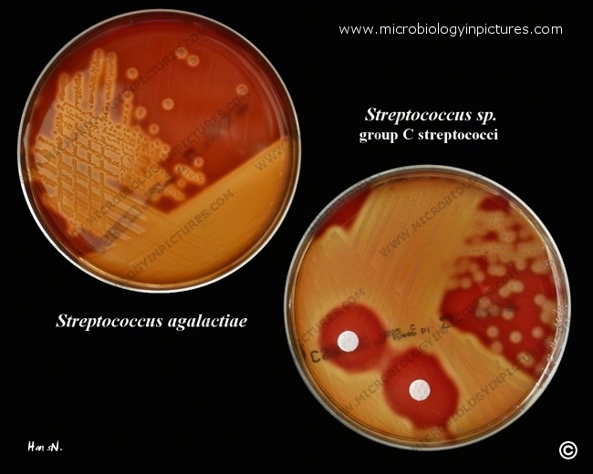 beta-hemolytic streptococci